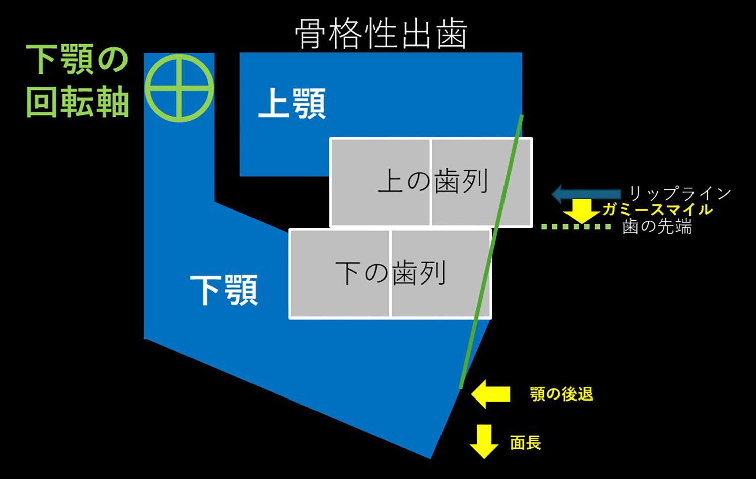 オートローテーションの仕組み 図①
