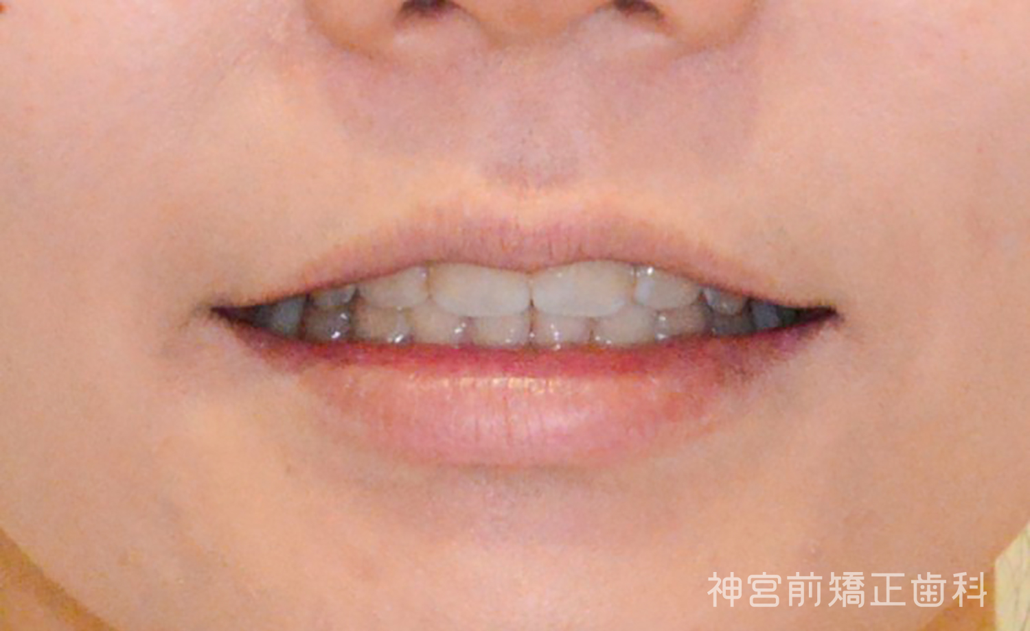 After